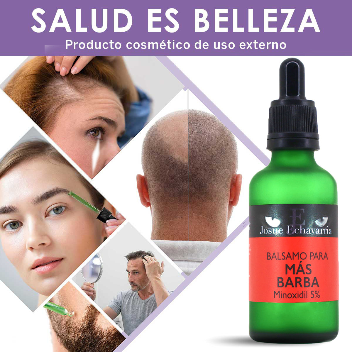Minoxidil 5% Con Bergamota 2 Frascos De 50ml Para 4 Meses